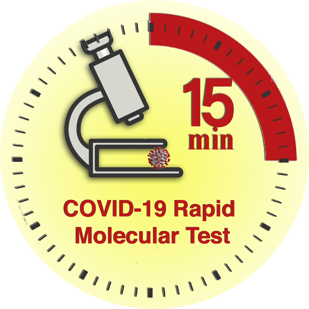 COVID-19 Rapid Molecular Test