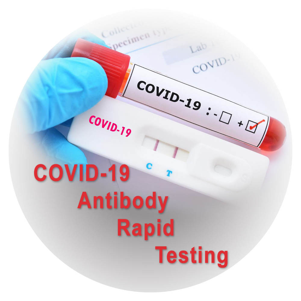 COVID-19 Antibody Testing